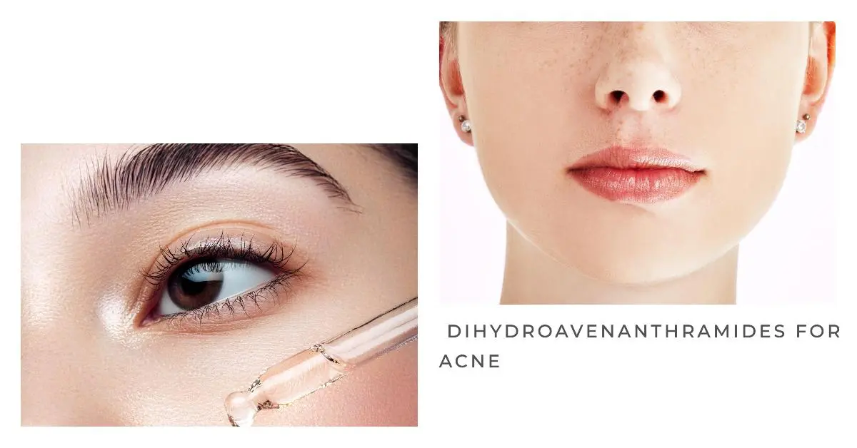 Dihydroavenanthramides-powder-supplier Dihydroavenanthramides-powder-supplier